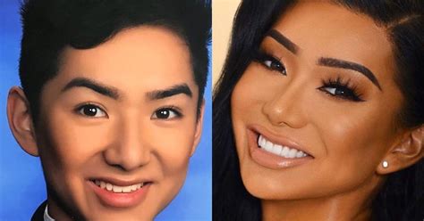 nikita dragun before|Nikita Dragun is Very Open About Her Plastic Surgery Journey